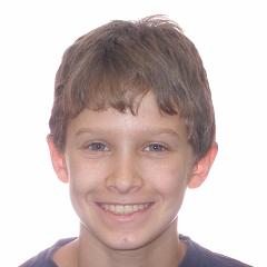 patient-5-orthodontics-final-frontal-smiling