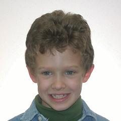 patient-5-orthodontics-initial-frontal-smiling