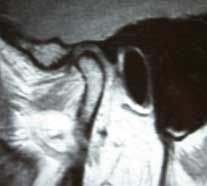joint-fig7
