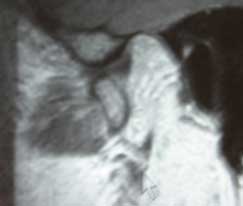 joint-fig8