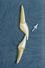 Fig 19. Maxillary incisors are subject to off-axis occlusal load whenever they touch.