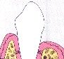 periodontal-disease-8