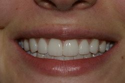 Cosmetic Makeover