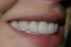 Cosmetic Makeover