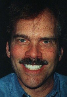Before and After with Porcelain Veneers and Crowns