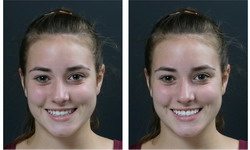 Cosmetic Makeover