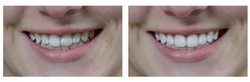 Cosmetic Makeover